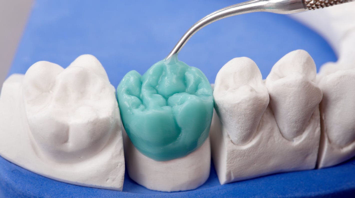 Use of waxes in dentistry