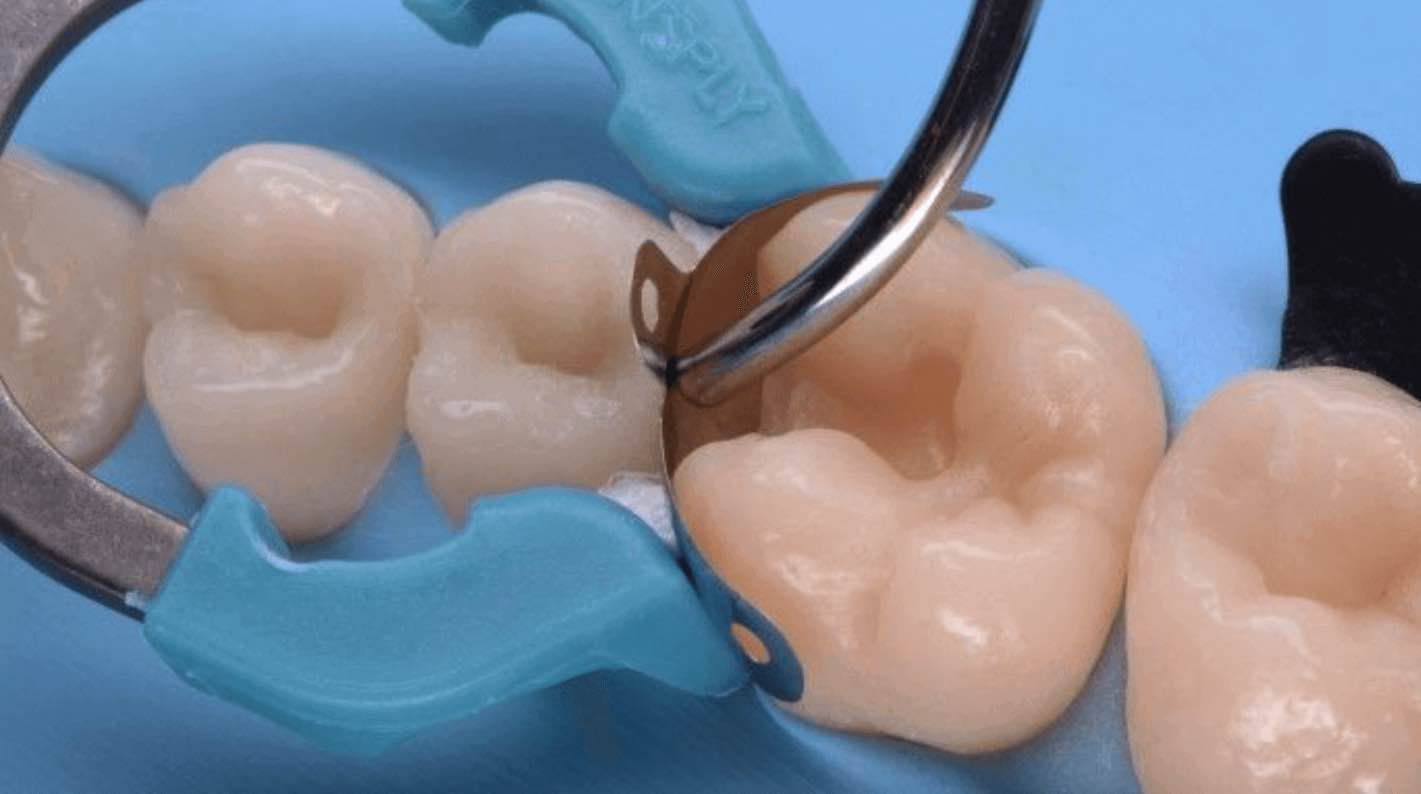 Preformed dental matrices