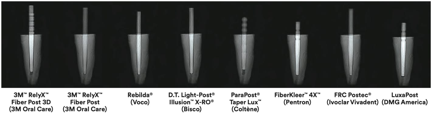 Radiopacity in fiberglass posts
