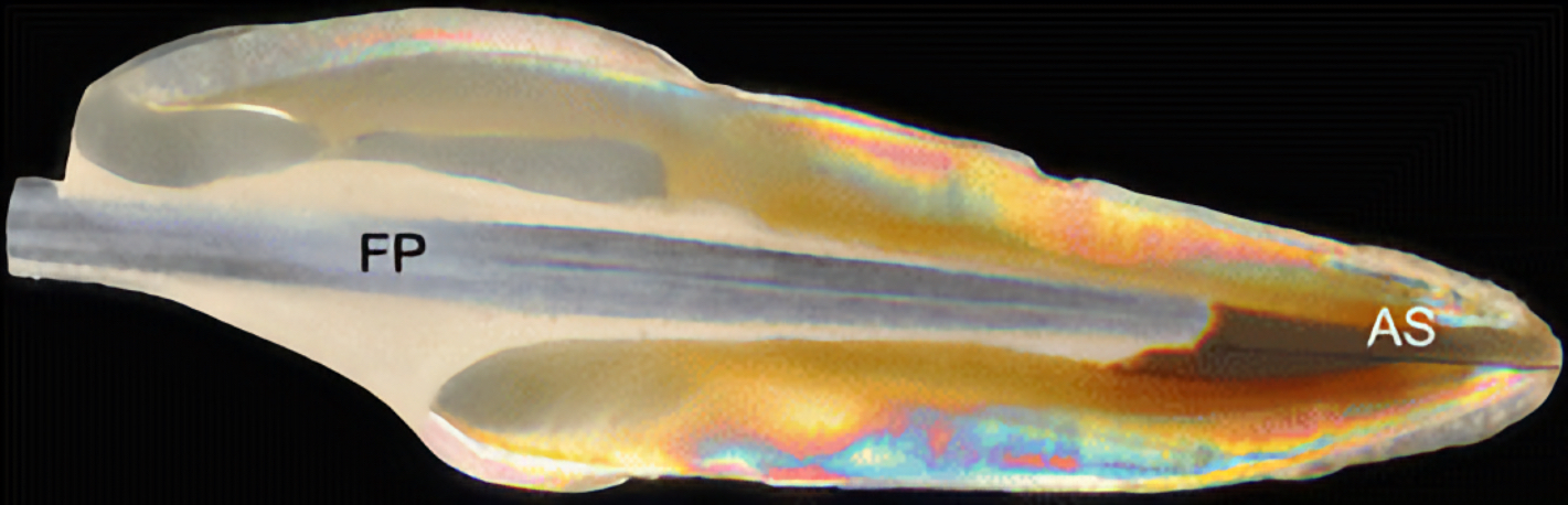 Tooth treated with fiberglass post
