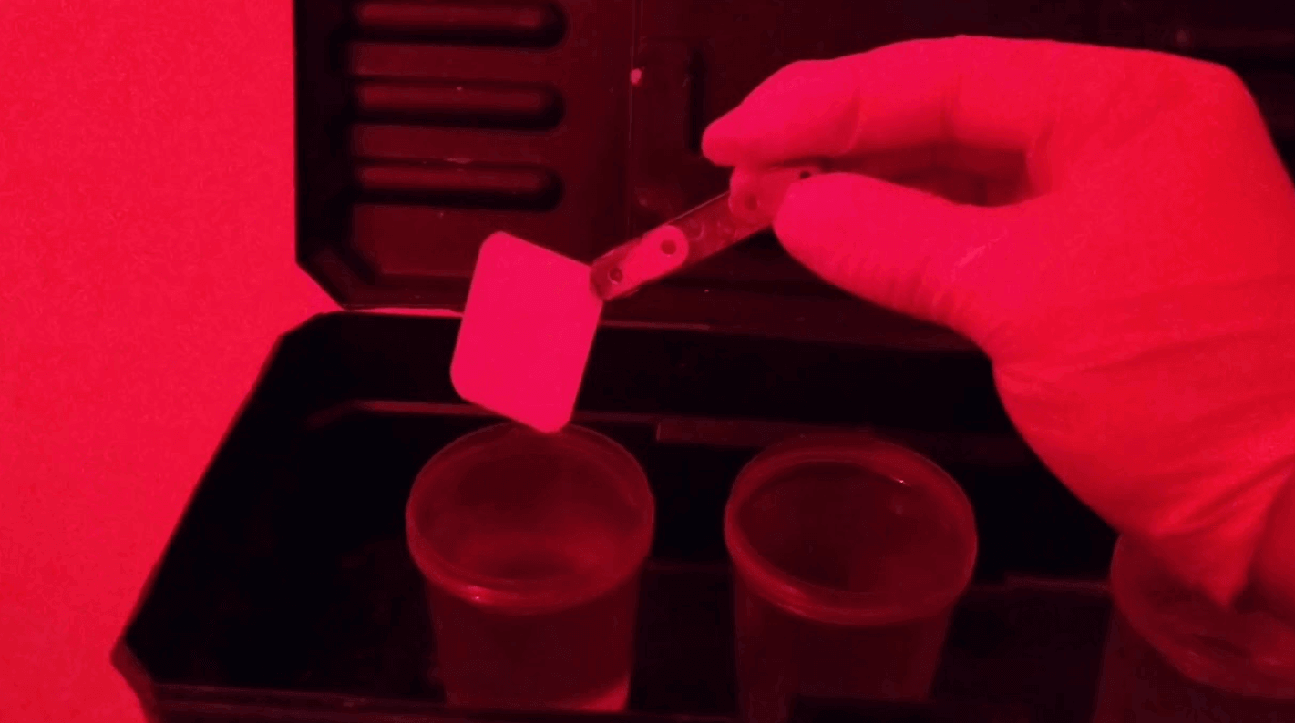 Toxic residues from radiographic fluids