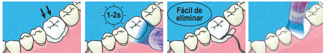 Cementado con OverCEM SA