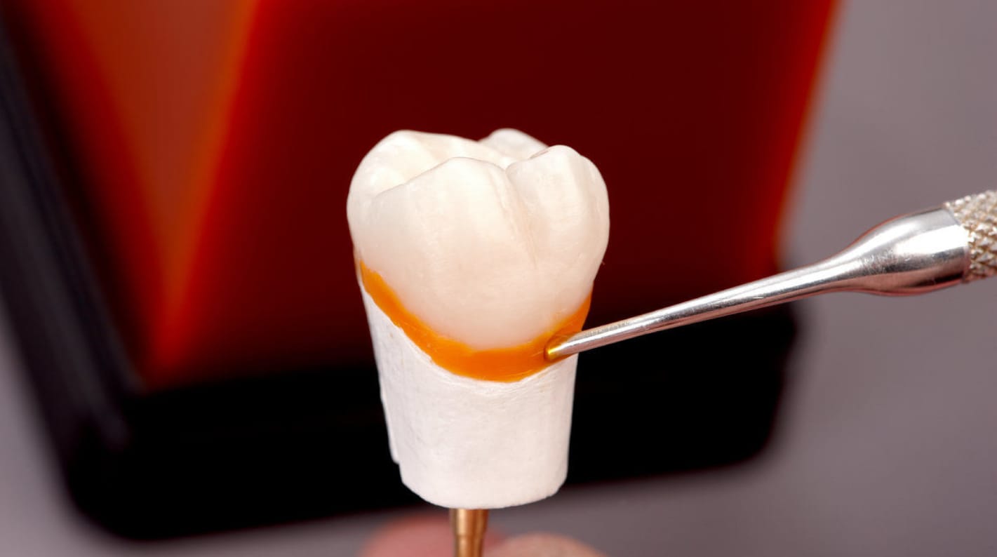 Waxes for modelling fixed prostheses