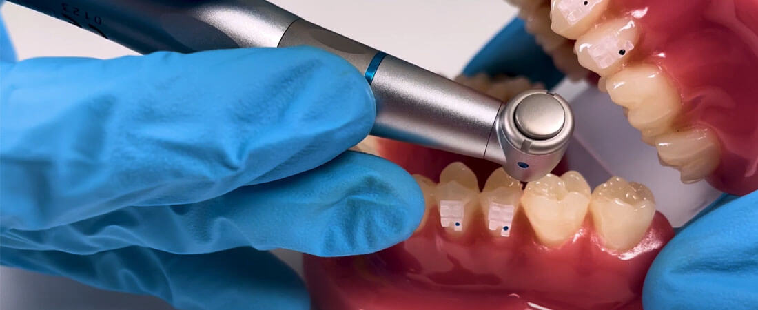 Dental contra-angles