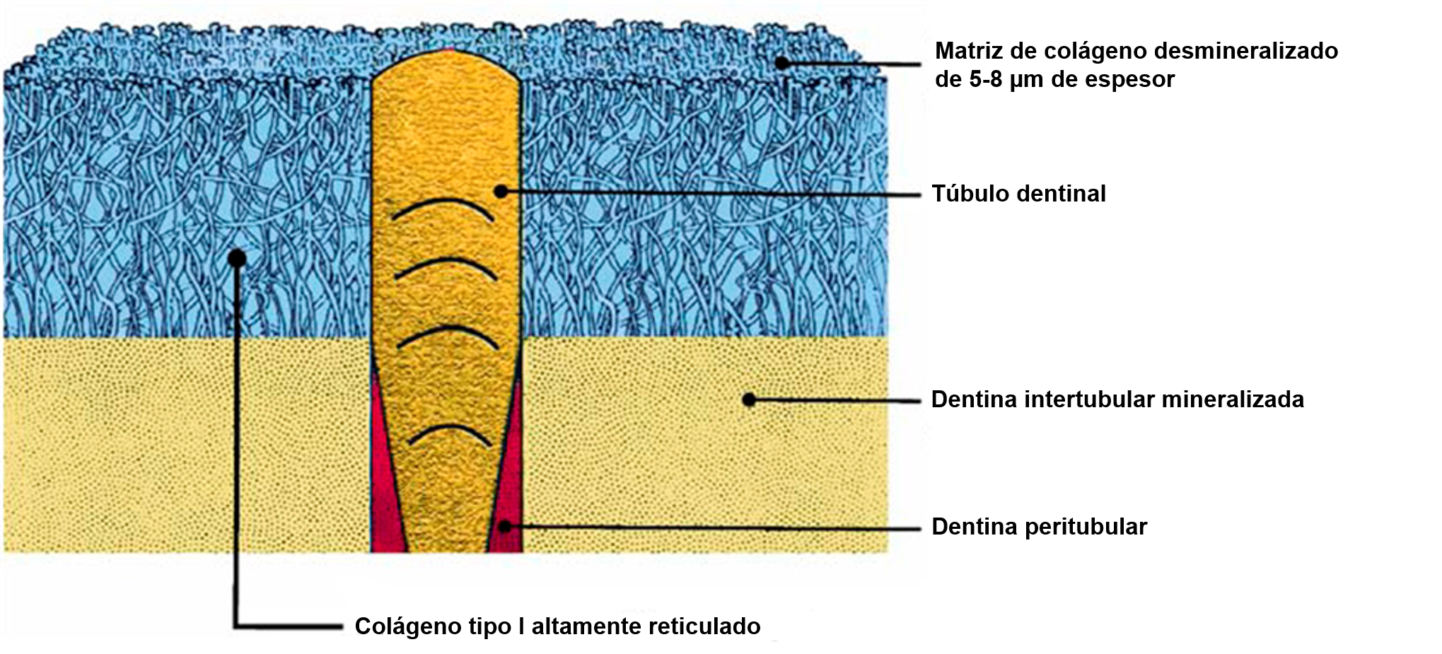Protocolo de desmineralización de la Dentina