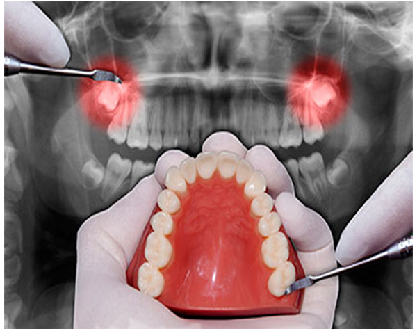 Dental surgery equipment