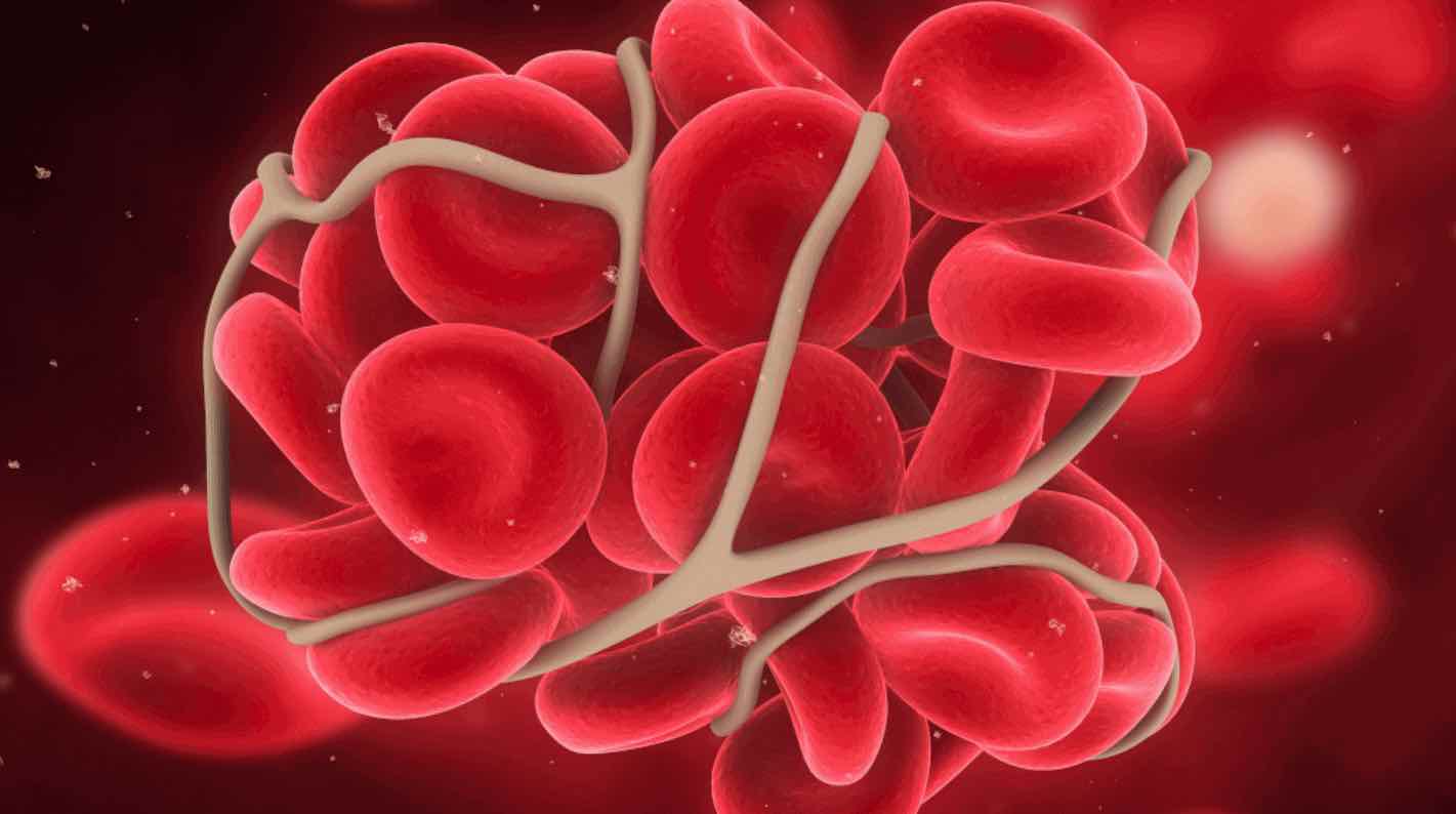 La hemostasia en odontología