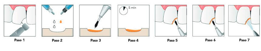 CPS Ceramic Silane Primer