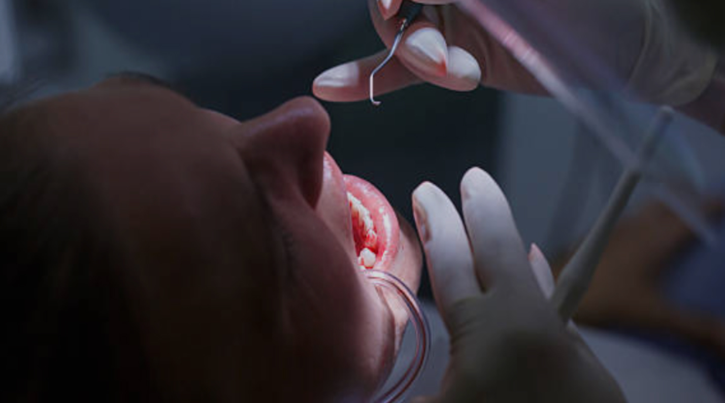 instrumental y material para periodoncia