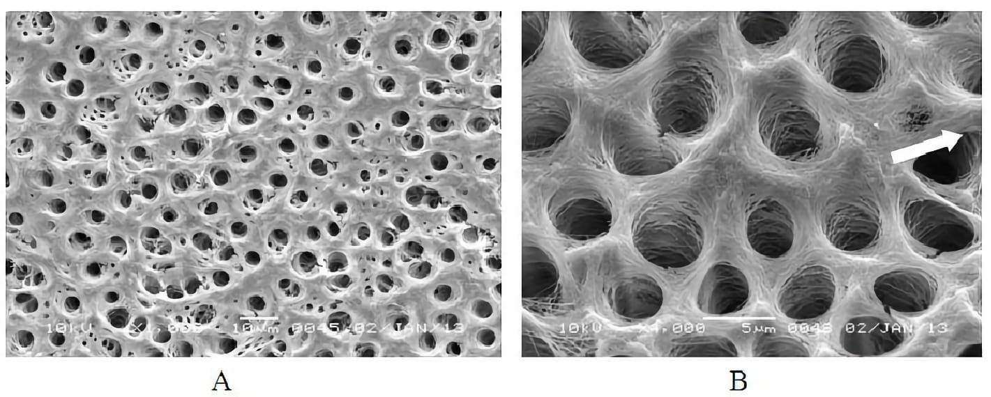 Microscopía electrónica irrigación con EDTA e hipoclorito de sodio