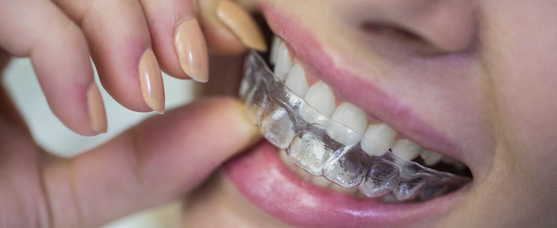 Dental thermoplastic sheets