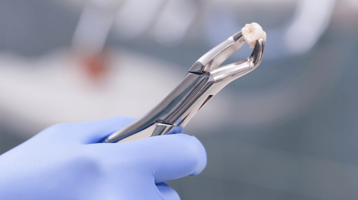 Tipos de fórceps dentales en odontología