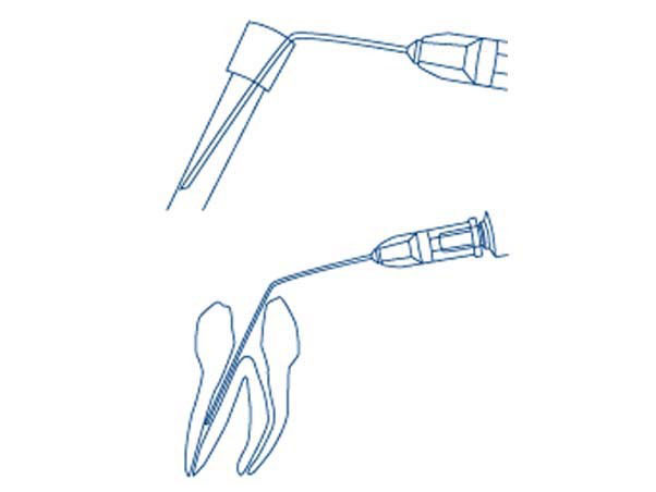 MIRAJECT ENDO LUER NEEDLES